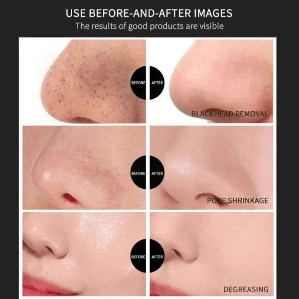 1pcs 6g Black Face Mask Blackhead Black Head Remover Makeup Peel Masks Acne Beauty Cleaning Mask Black Black From Dots Skin - Image 5